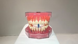 dental model closed mouth