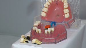 Still from video: dental model open record button